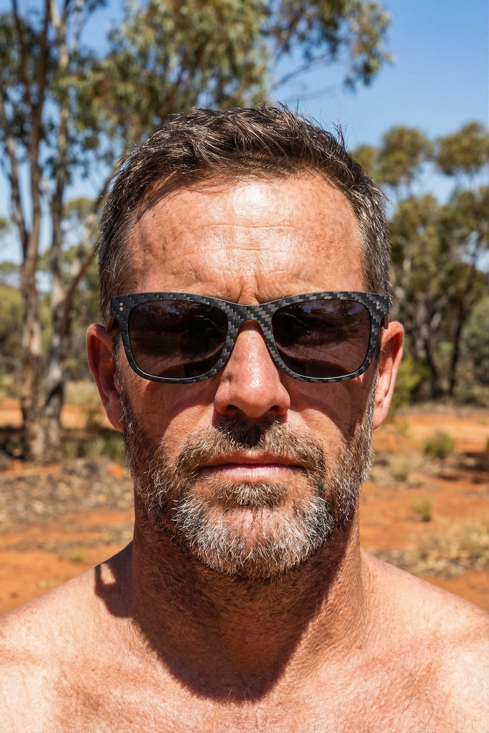 November Is Melanoma Month — And Your Eyes Need Protection Too